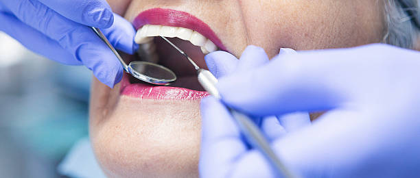 Best Broken or Cracked Tooth Emergency Dentist in Flowood, MS